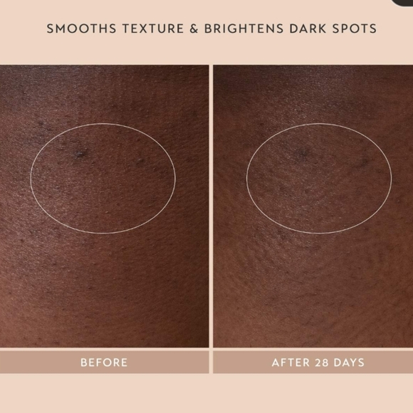 NIB SHANI DARDEN BODY REFORM TREATMENT SERUM - Picture 8 of 16